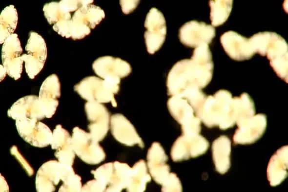 Microscopic View of Golden Microorganisms Floating Against Black Background